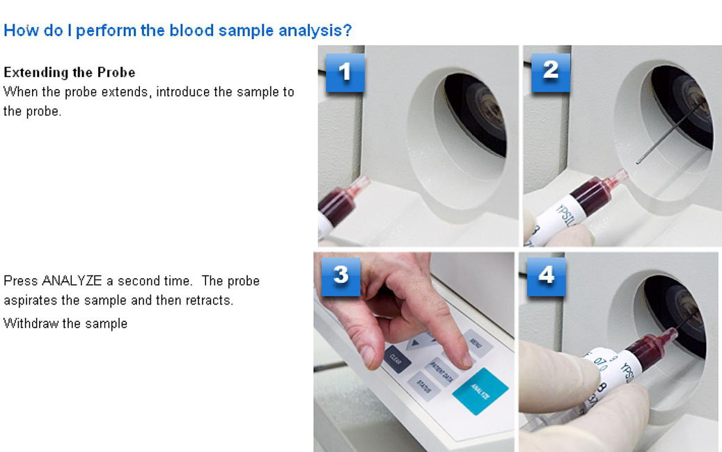 Images of blood sample analysis being performed