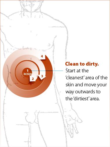 image of how to clean a person's intestinal area