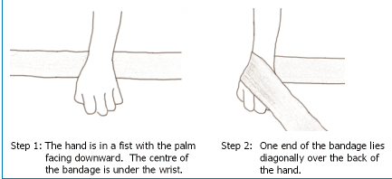 drawing of hand, and the first steps to bandaging a hand