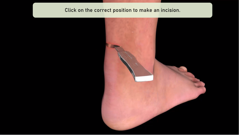 Animations are used for interactive contents to practice surgical procedure